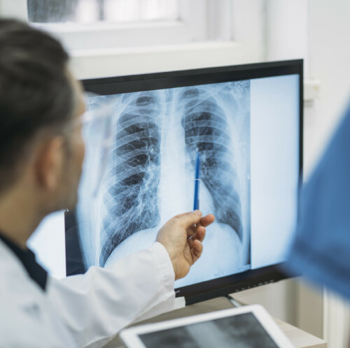 Close up of doctors analysing radiological chest x-ray film