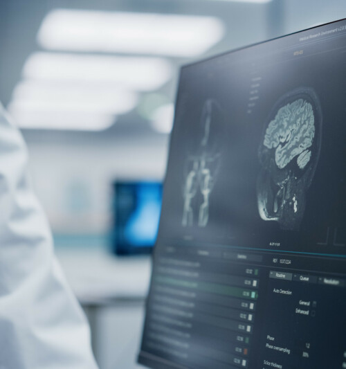 Medical Hospital: Neurologist and Neurosurgeon Talk, Use Computer, Analyse Patient MRI Scan, Diagnose Brain. Brain Surgery Health Clinic Lab: Two Professional Physicians Look at CT Scan. Close-up